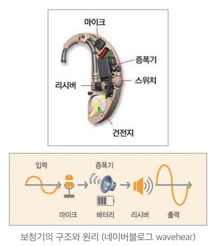 보청기의 구조와 원리 / 블로그 갈무리